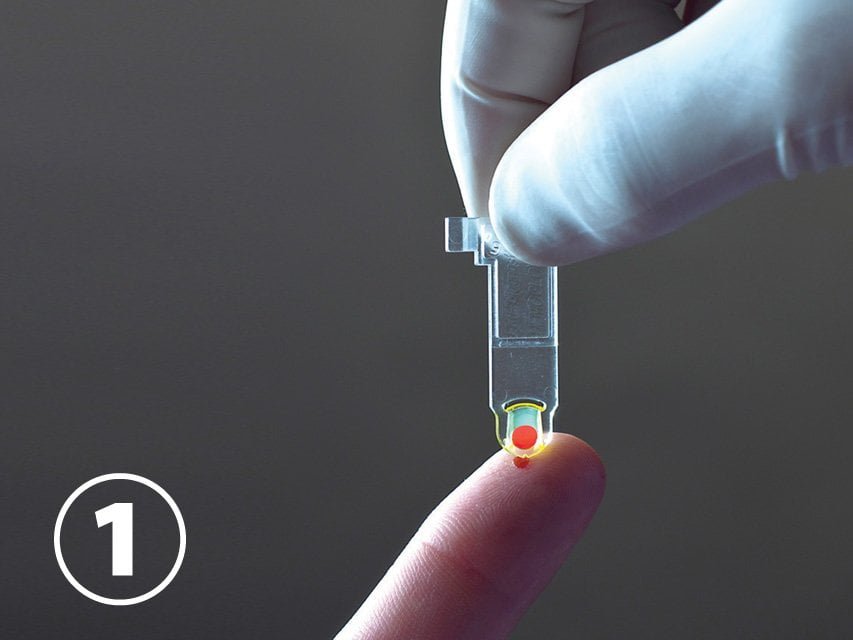 HEMO CONTROL: hemoglobin and hematocrit measurer