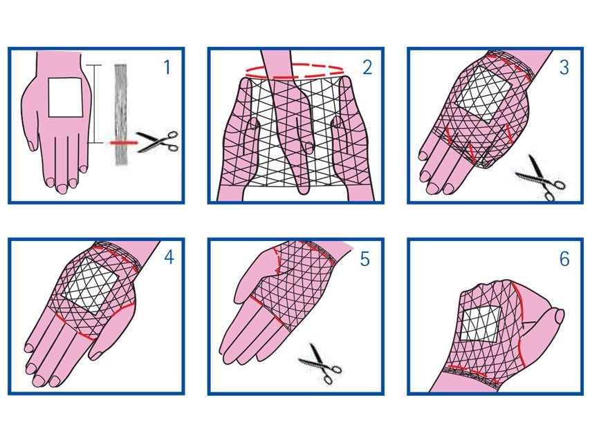 ELASTIC TUBULAR NETTING 2 for wrist and hand