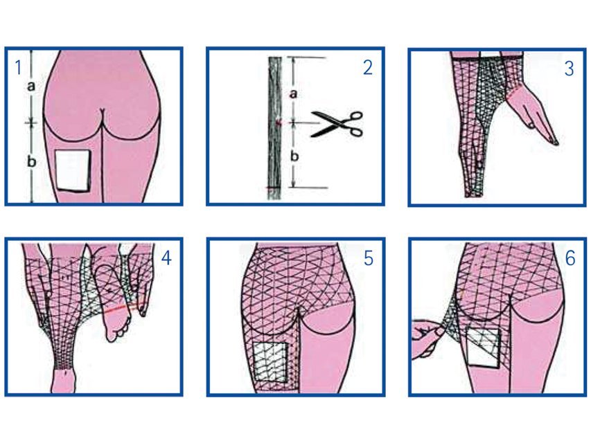 ELASTIC TUBULAR NETTING 7 for body, pelvis and thigh