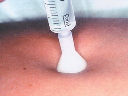 S.I.T. SKIN INJECTION THERAPY 31G 0,26X2.5 mm - white