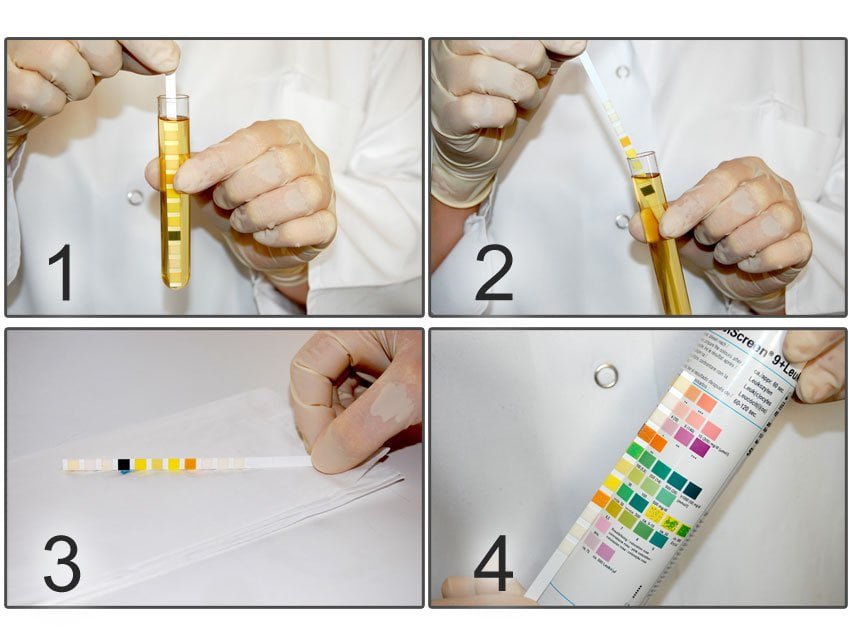 COMBI SCREEN 10SL PLUS URINE STRIPS - 10 parameters
