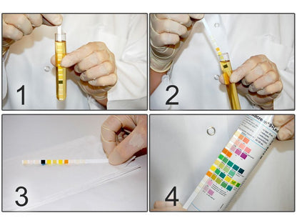 COMBI SCREEN 11SYS PLUS URINE STRIPS - 11 parameters
