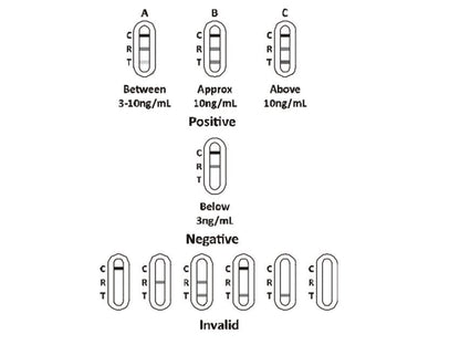 PSA PROSTATA TEST - professional