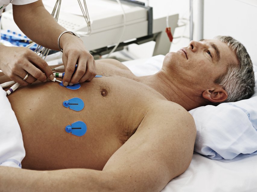 AMBU BLUE SENSOR SU ECG ELECTRODES - 4 mm