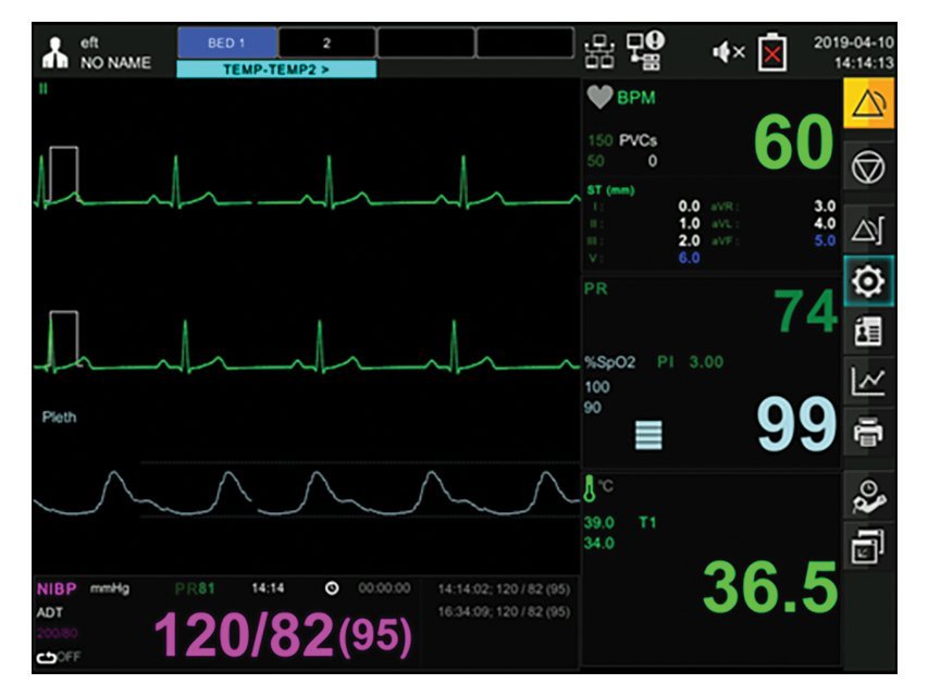 GIMA BM3 PRO MULTIPARAMETER TOUCH SCREEN MONITOR -