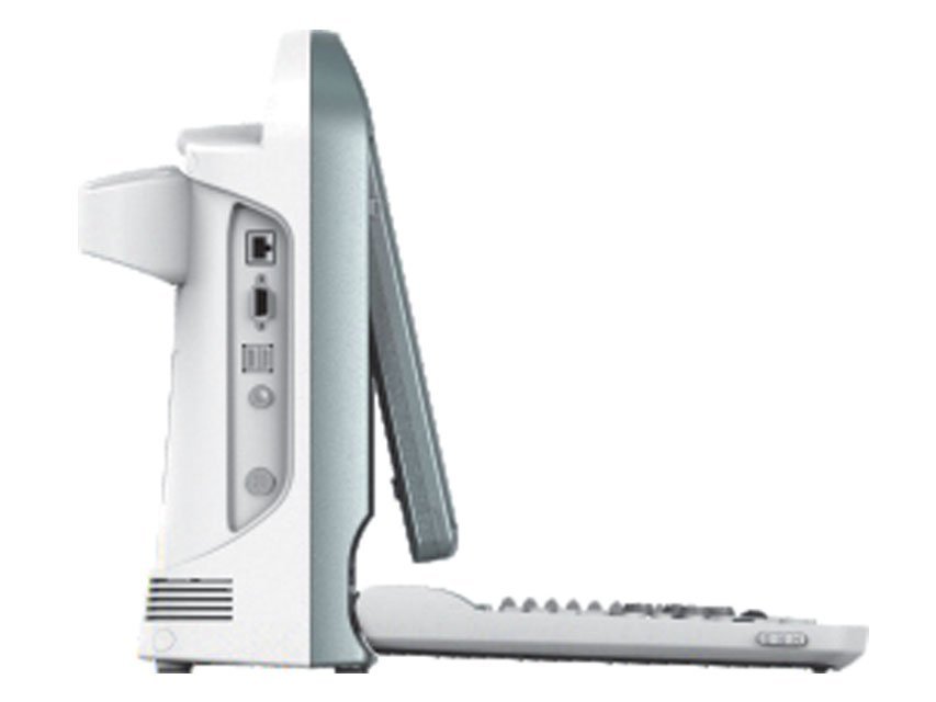 CHISON ECO 5 VET ULTRASOUND