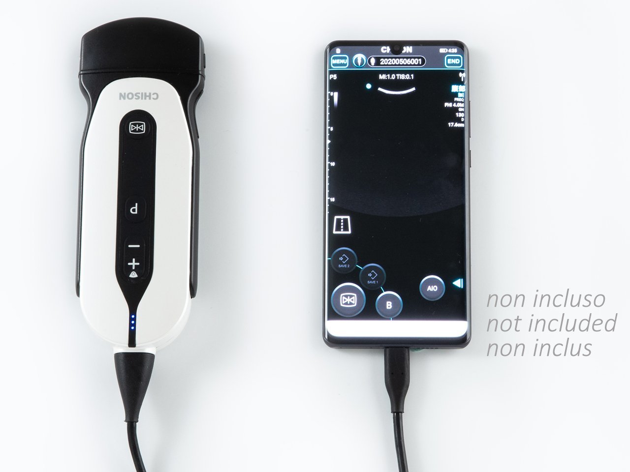 SONOEYE P5 DIGITAL COLOUR DOPPLER - Convex Probe