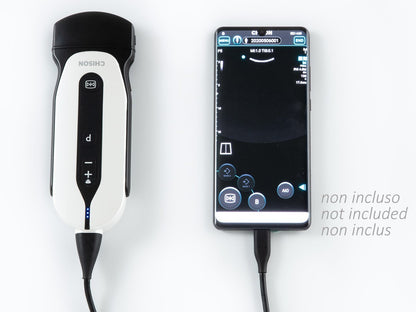 SONOEYE P5 DIGITAL COLOUR DOPPLER - Convex Probe