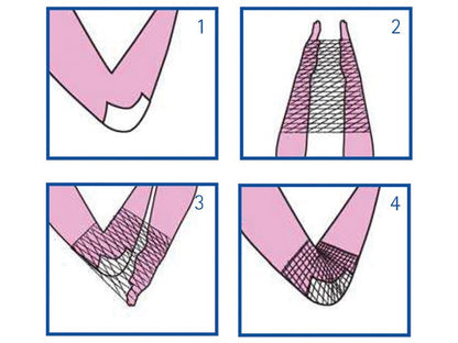 ELASTIC TUBULAR NETTING 3 for hand, elbow and arm