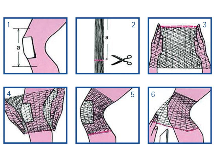 ELASTIC TUBULAR NETTING 5 for foot, knee and leg