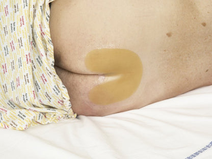 TEGADERM 3M HYDROCOLLOID 16x17 cm - sacral