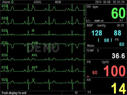 PC-3000 MULTI-PARAMETER PATIENT MONITOR