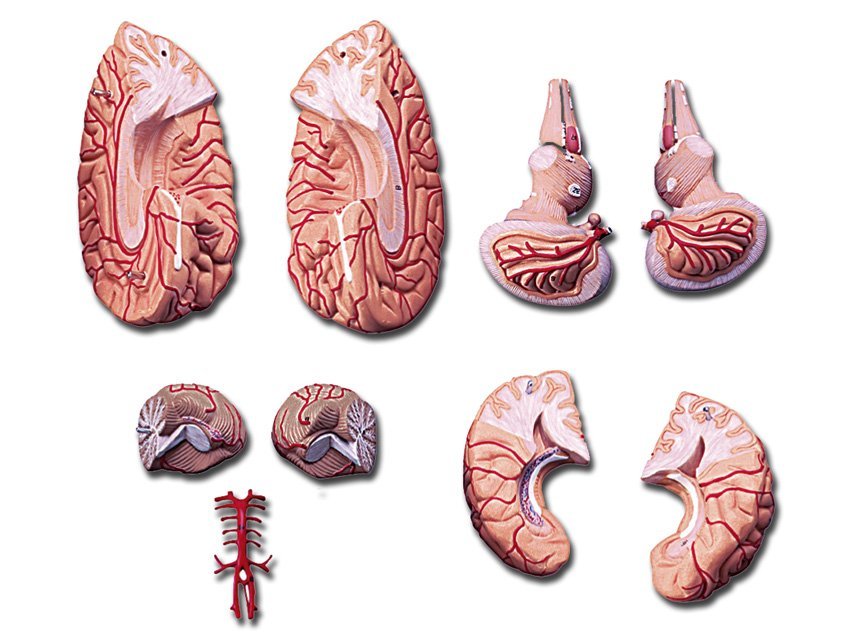 BRAIN WITH ARTERIES