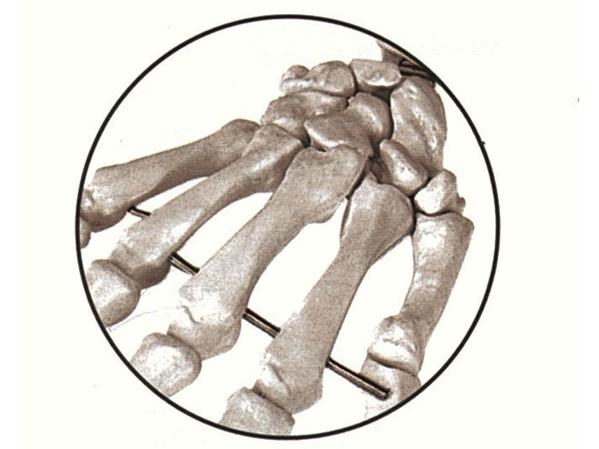 HUMAN SKELETON