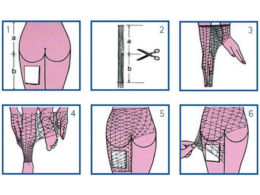 ELASTIC TUBULAR NETTING G for body, pelvis, thigh - latex free